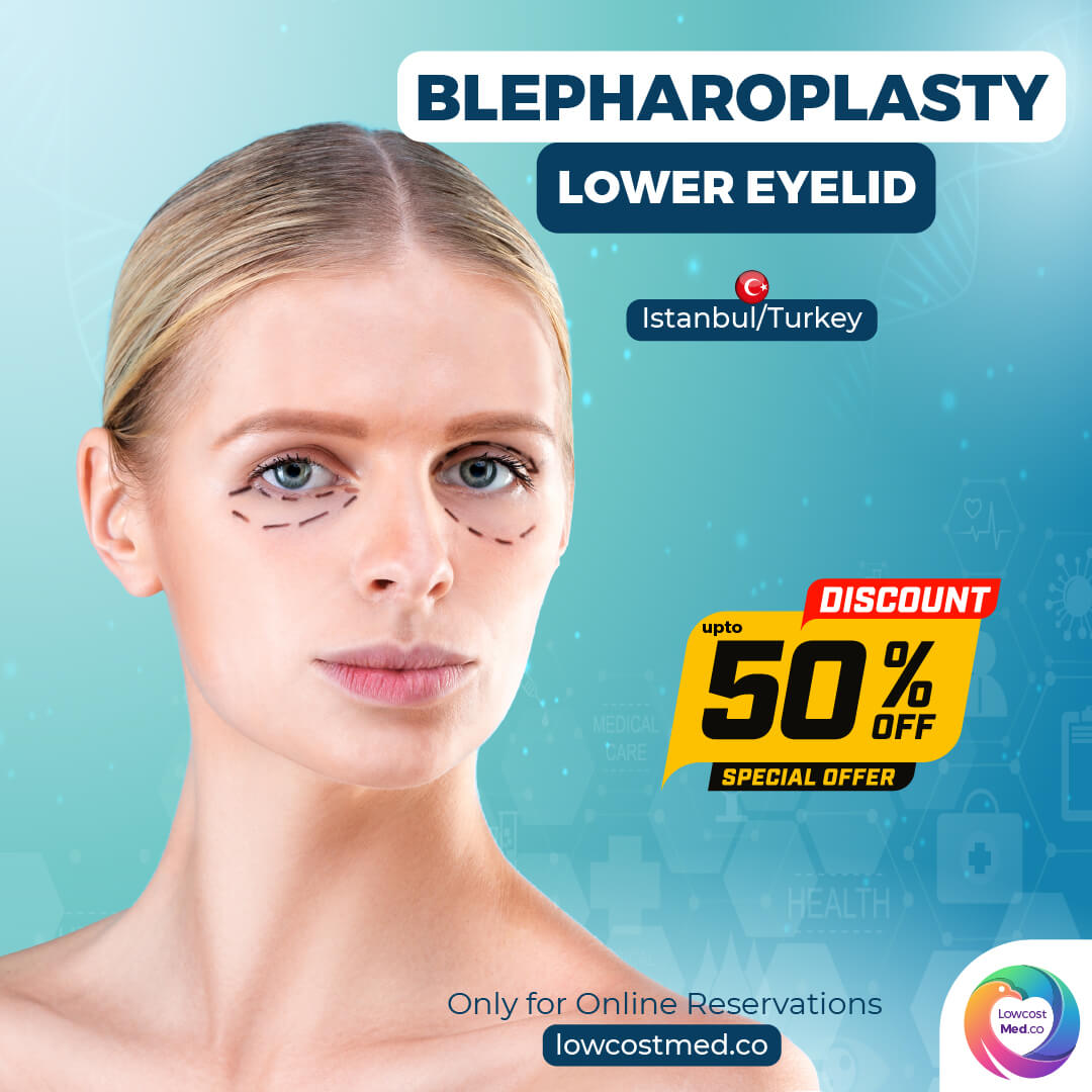 Blepharoplasty - Lower Eyelid