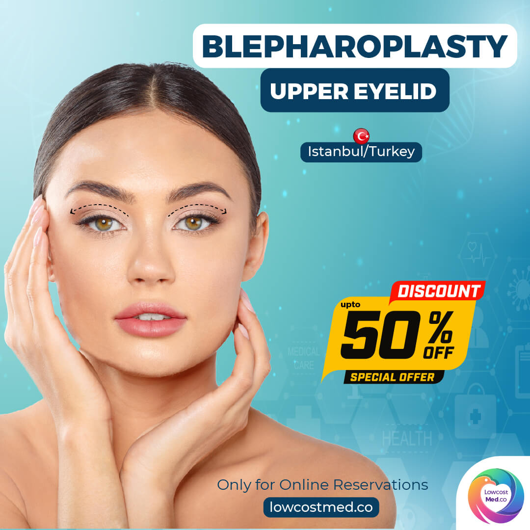 Blepharoplasty - Upper Eyelid