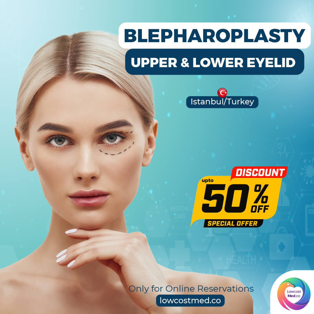 Blepharoplasty - Upper & Lower Eyelids